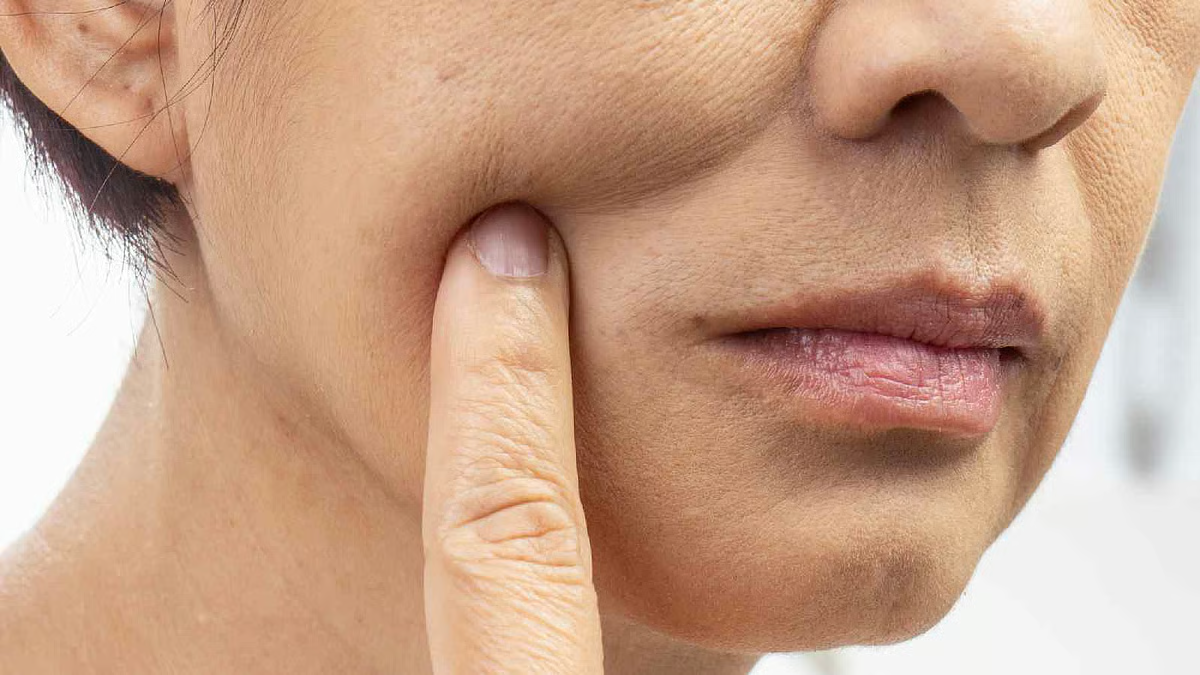 How to figure out if your skin is dry or dehydrated?