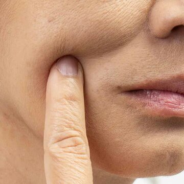 How to figure out if your skin is dry or dehydrated?