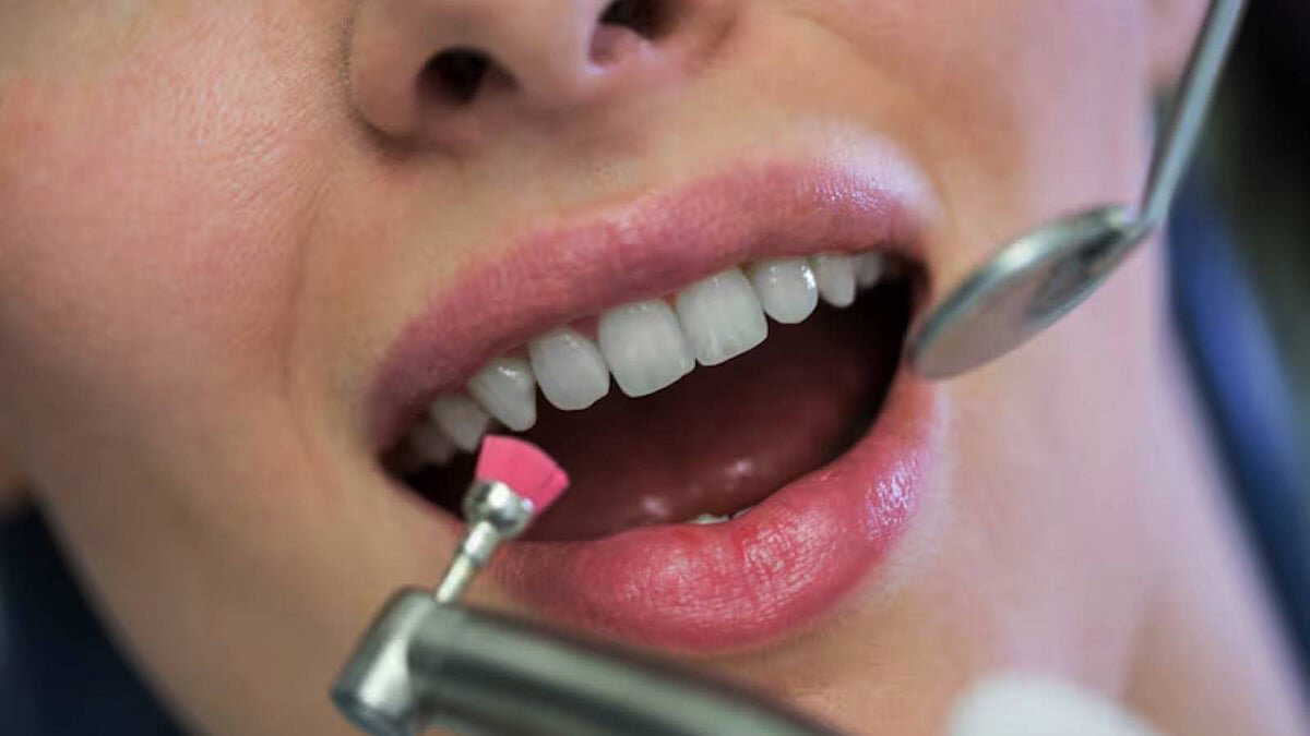 Healthy drinks, hidden risk: How lemon water and green tea affect tooth enamel