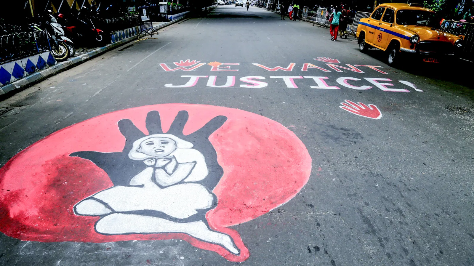 Minor patient allegedly assaulted Inside SSKM hospital toilet, NRS worker arrested