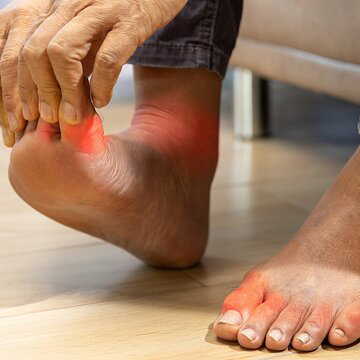 From diet to daily routine: Key reasons uric acid levels worsen joint pain