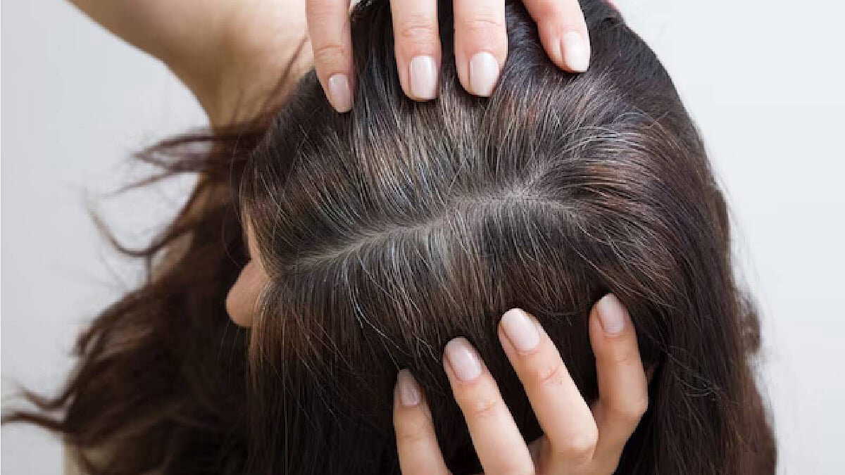 Premature greying can be prevented with home remedies – do you know how?