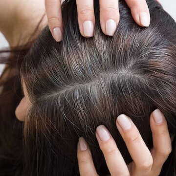 Premature greying can be prevented with home remedies – do you know how?