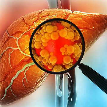 Always tired? It could be a sign of fatty liver from B12 deficiency