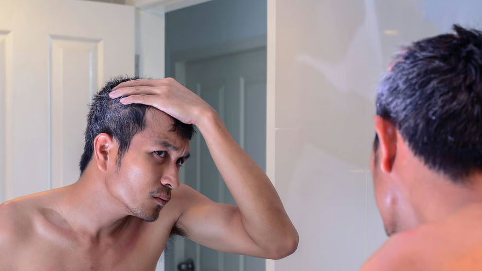 Early greying of hair might not mean aging, scientists reveal a surprising reason