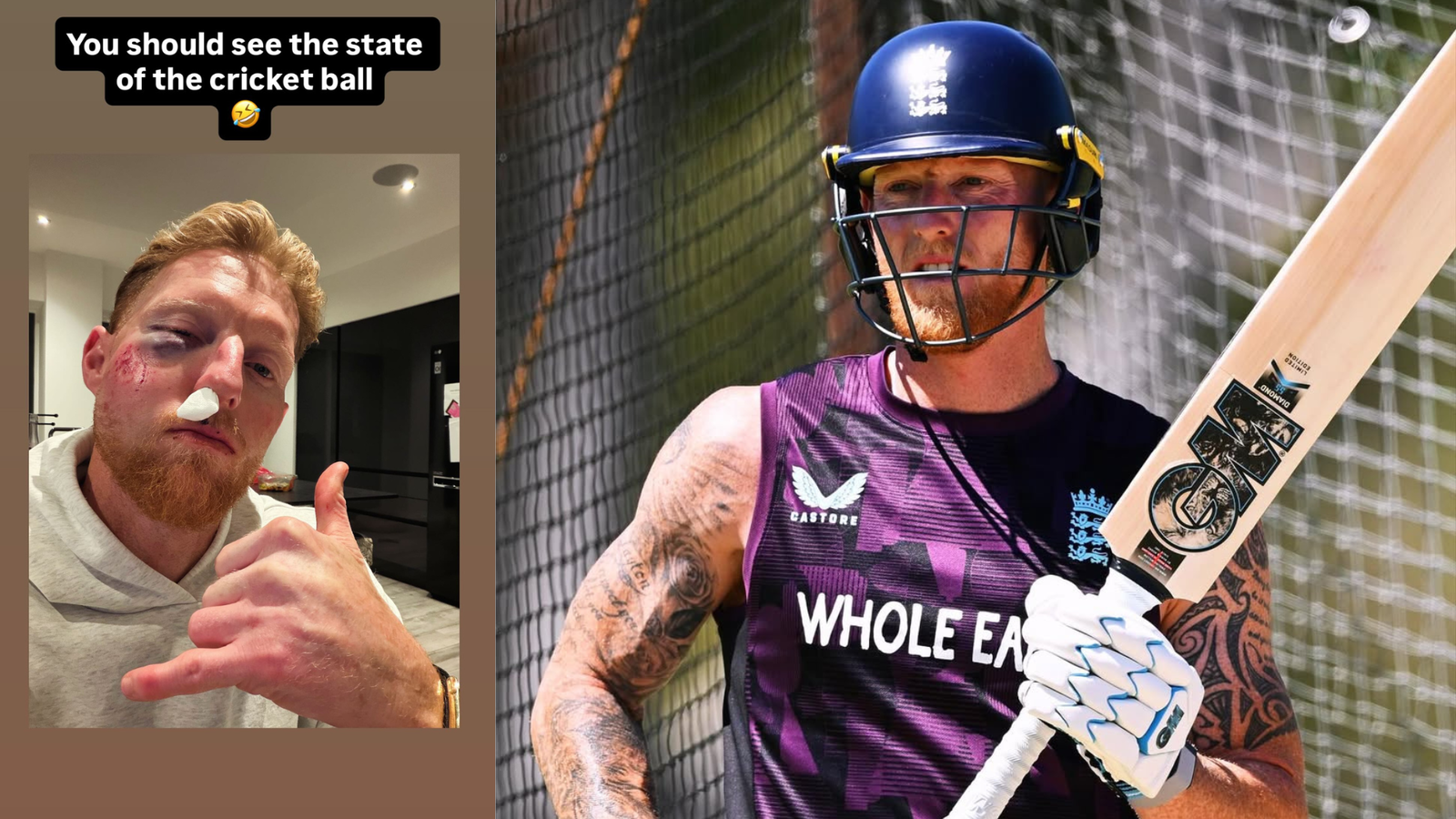 ‘You should see the state of...’: Ben Stokes posts injury update after ball hits him flush on face during training session