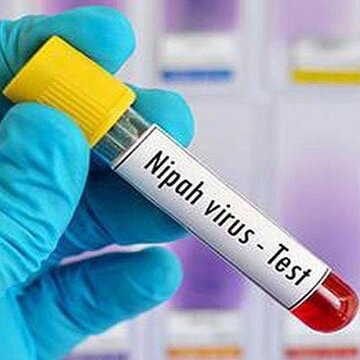 Nipah virus claims 25-year-old nurse after prolonged treatment, infected colleague makes recovery