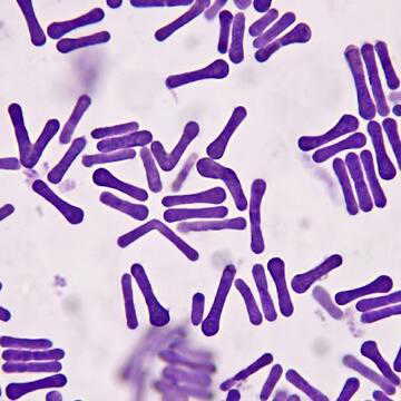 Australia fights biggest diphtheria outbreak in decades as cases cross 230