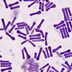 Australia fights biggest diphtheria outbreak in decades as cases cross 230