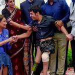 Trinidad and Tobago PM hails Modi for Jaipur Foot camp, announces permanent centre