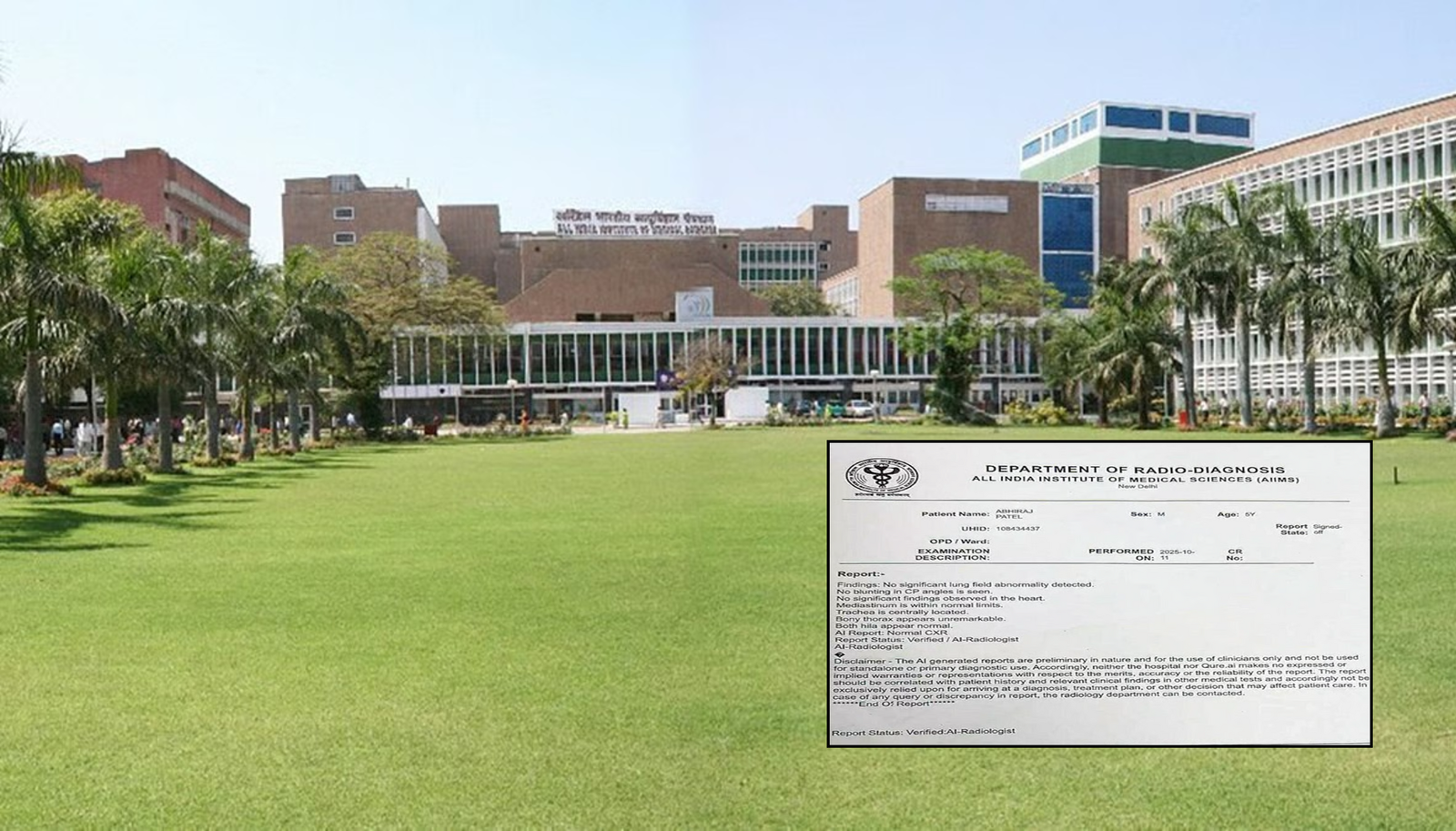 AI-generated X-Ray report at Delhi AIIMS sparks debate on social media