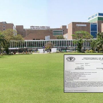 AI-generated X-Ray report at Delhi AIIMS sparks debate on social media