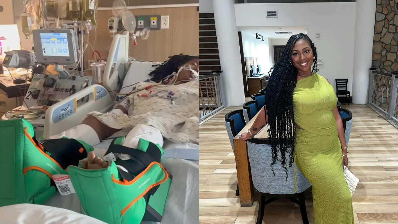 ‘Heart rate was stuck between 140-160 for days', Women's skin peels 'like a snake' after a venomous spider bite| watch