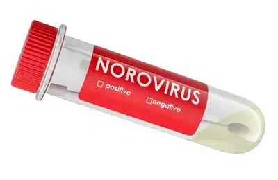 Norovirus activity remains elevated across US beyond usual seasonal peak