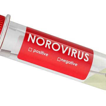 Norovirus activity remains elevated across US beyond usual seasonal peak