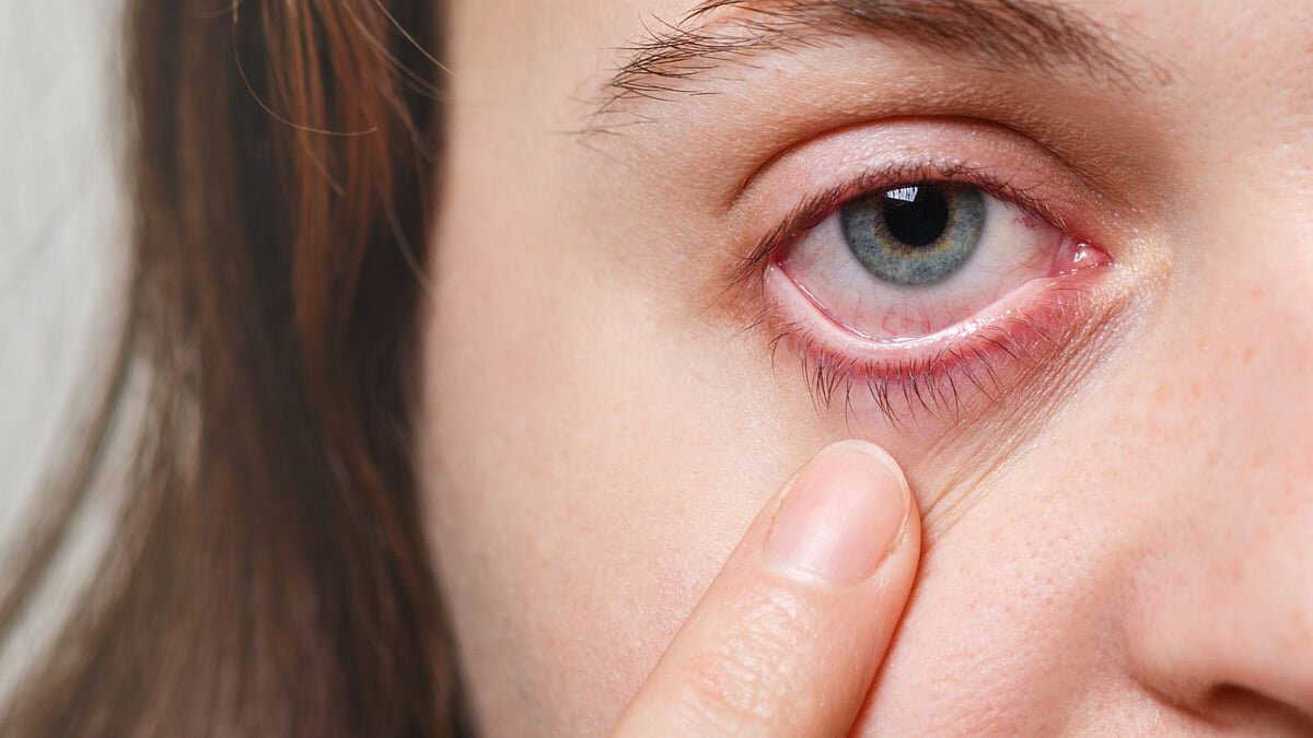 Dry, irritated eyes in winter? Here’s why the problem increases and what you can do