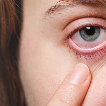 Dry, irritated eyes in winter? Here’s why the problem increases and what you can do