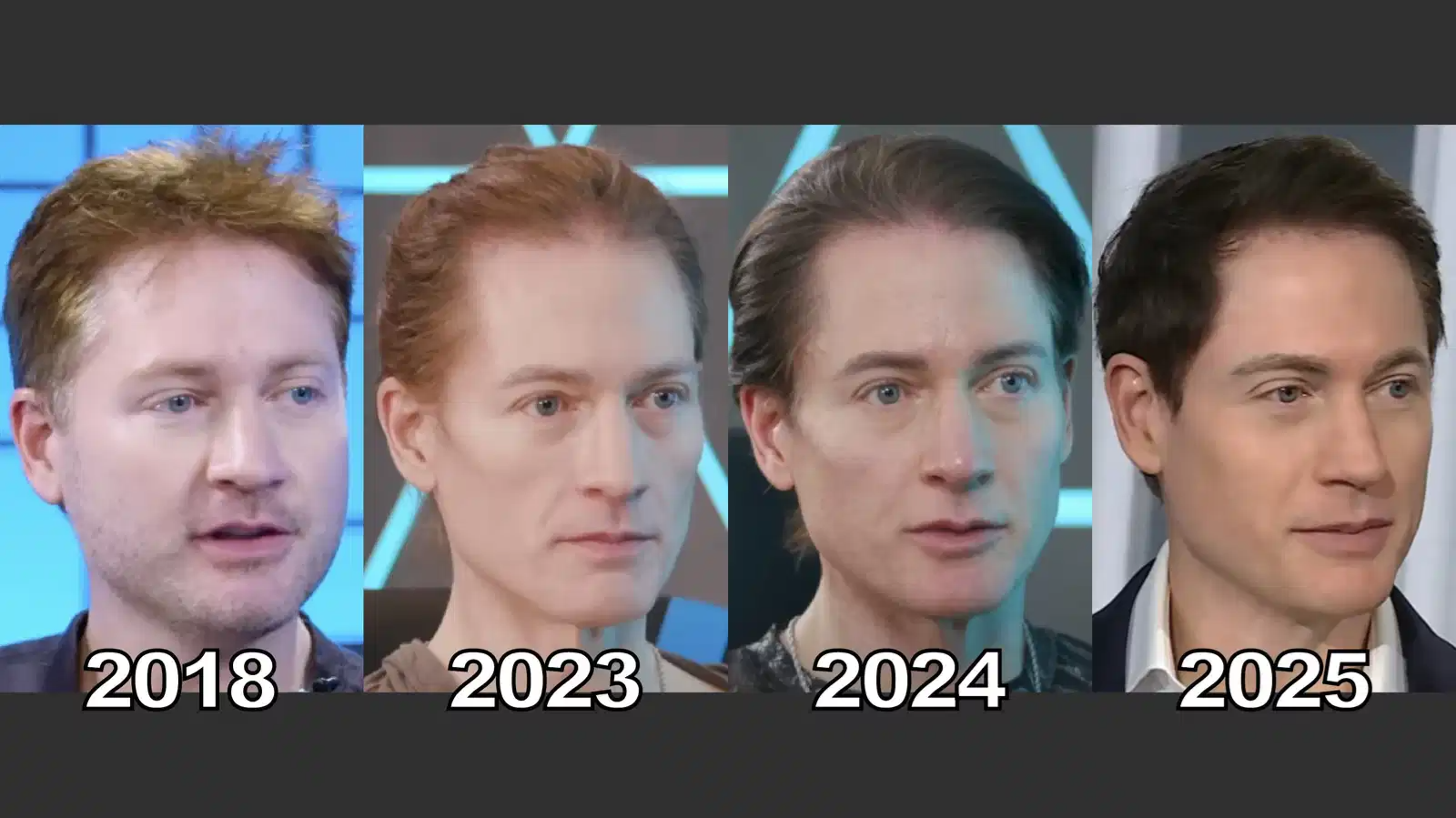 'Immortality by 2039': Tech millionaire Bryan Johnson says his body has stopped ageing