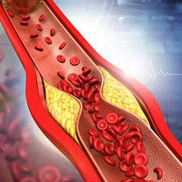 Cholesterol rising? Add these 7 vegetables to your plate
