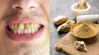 Can brushing with Multani clay whiten teeth? Viral trend raises health concerns