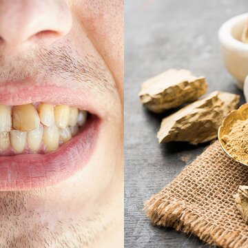 Can brushing with Multani clay whiten teeth? Viral trend raises health concerns