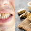 Can brushing with Multani clay whiten teeth? Viral trend raises health concerns