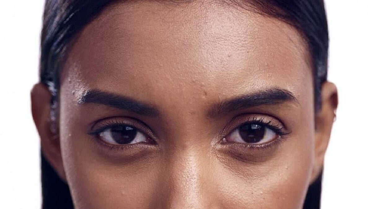 Why do dark circles form under the eyes? What are the ways to solve them?