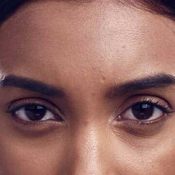 Why do dark circles form under the eyes? What are the ways to solve them?