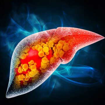 Struggling with fatty liver? These everyday foods can help reverse the damage