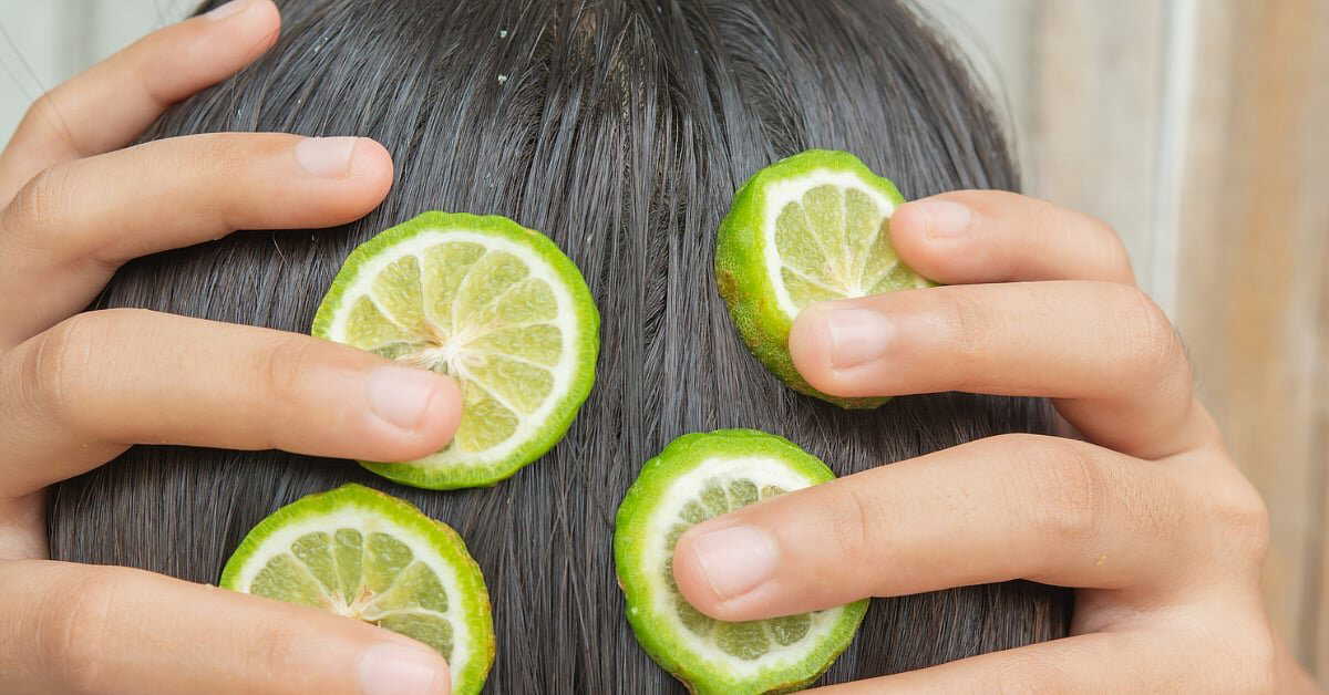 Lemon for dandruff? Here’s the right way to use it without damaging your scalp