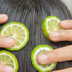 Lemon for dandruff? Here’s the right way to use it without damaging your scalp