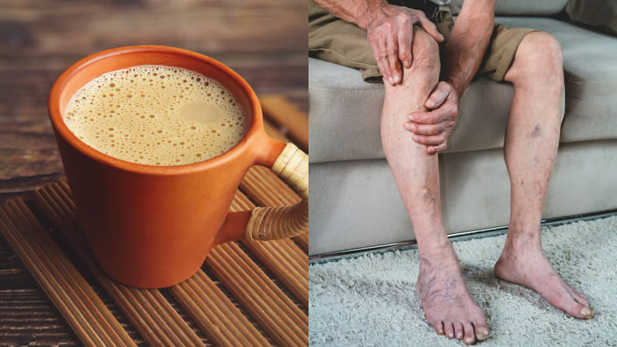 Winter joint pain: How excess tea and coffee can worsen your gout and arthritis