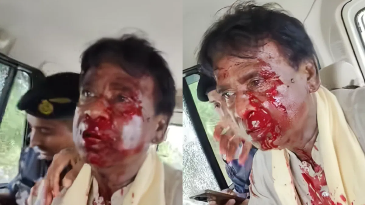 North Bengal floods: BJP MP Khagen Murmu sustains serious injuries during visit