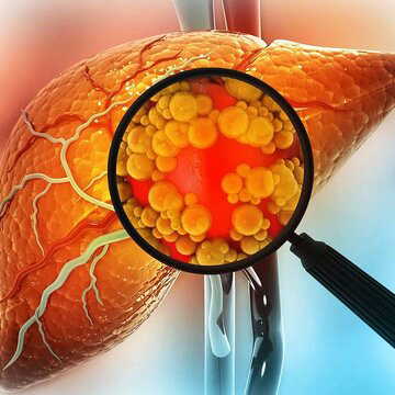 Want to keep fatty liver problems under control? Practice these 3 yoga asanas daily