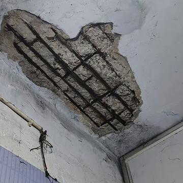 NRS अस्पताल में बड़ा हादसा टला : CCU की छत का हिस्सा टूट कर गिरा, बाल-बाल बचे मरीज