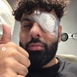 रैपर बादशाह ने शेयर की आंखों पर पट्टी और सूजन के साथ तस्वीर, फैंस परेशान