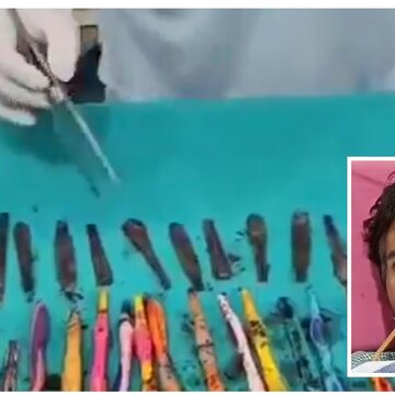 उत्तर प्रदेश के युवक को चम्मच-टूथब्रश-पेन पानी के साथ निगलने की लत