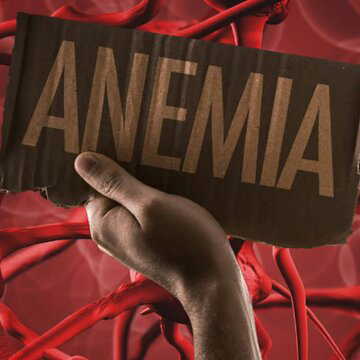 एनीमिया से बचाव का आसान तरीका: संतुलित आहार