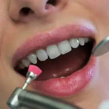 दांतों के एनामेल को नुकसान पहुंचाने वाले खाद्य पदार्थ, क्या आप जानते हैं कौन-से हैं वे?