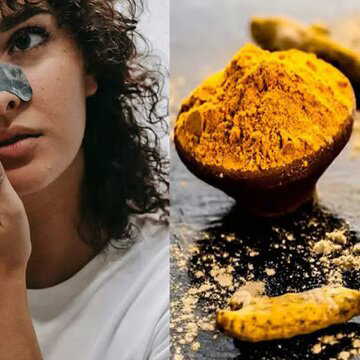 जिद्दी ब्लैकहेड्स से परेशान हैं? अपनाएं ये असरदार घरेलू नुस्खे