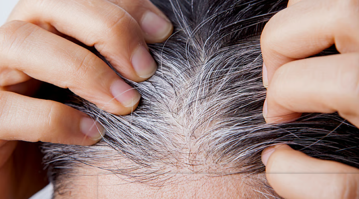 सफेद बाल बढ़ रहे हैं, मांग चौड़ी हो रही है? सिर पर लगाएं इन 6 तत्वों से बना हर्बल तेल