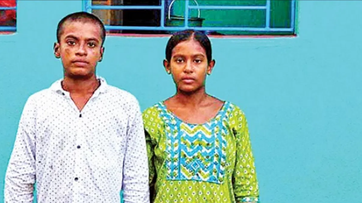 आग में खो दिया परिवार, भाई-बहन की देखभाल कर रहे पड़ोसी