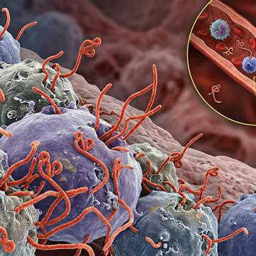 Ebola Outbreak : ग्लोबल हेल्थ इमरजेंसी घोषित, क्या है इबोला वायरस? क्या है लक्षण और कैसे करें बचाव?