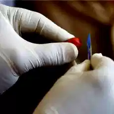 गलत HIV आंकड़ों पर नेशनल असेंबली पैनल में चेतावनी, पाकिस्तान को वैश्विक शर्मिंदगी का खतरा