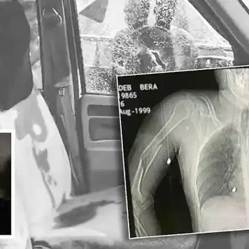 चंद्रनाथ रथ के पोस्टमार्टम की प्राथमिक रिपोर्ट से क्या मिली जानकारी? सामने आयी मौत की वजह