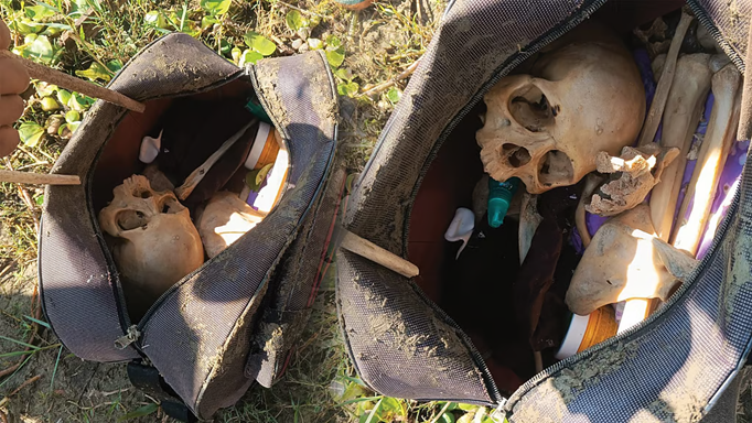 बैग खोलते ही उसमें से निकली खोपड़ी...इलाके में सनसनी