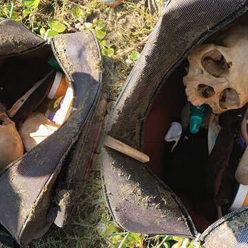 बैग खोलते ही उसमें से निकली खोपड़ी...इलाके में सनसनी