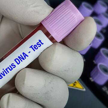 क्रूज जहाज पर हंता वायरस का प्रकोप: तीन यात्री अस्पताल में भर्ती