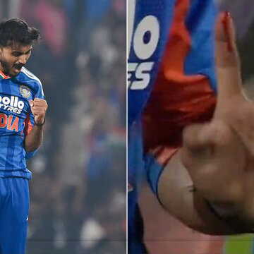 फील्डिंग के दौरान अक्षर की उंगली में फ्रैक्चर, विश्व कप से पहले बढ़ी चिंता