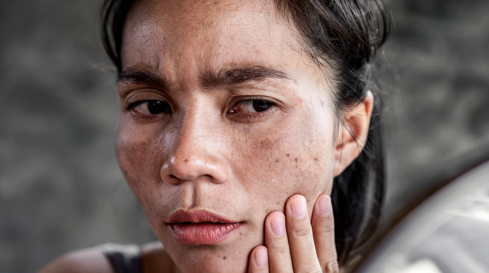 पटाखों के धुएं ने छिन ली चेहरे की रौनक, जानिए फिर से कैसे लौटेगी पुरानी वाली चमक?